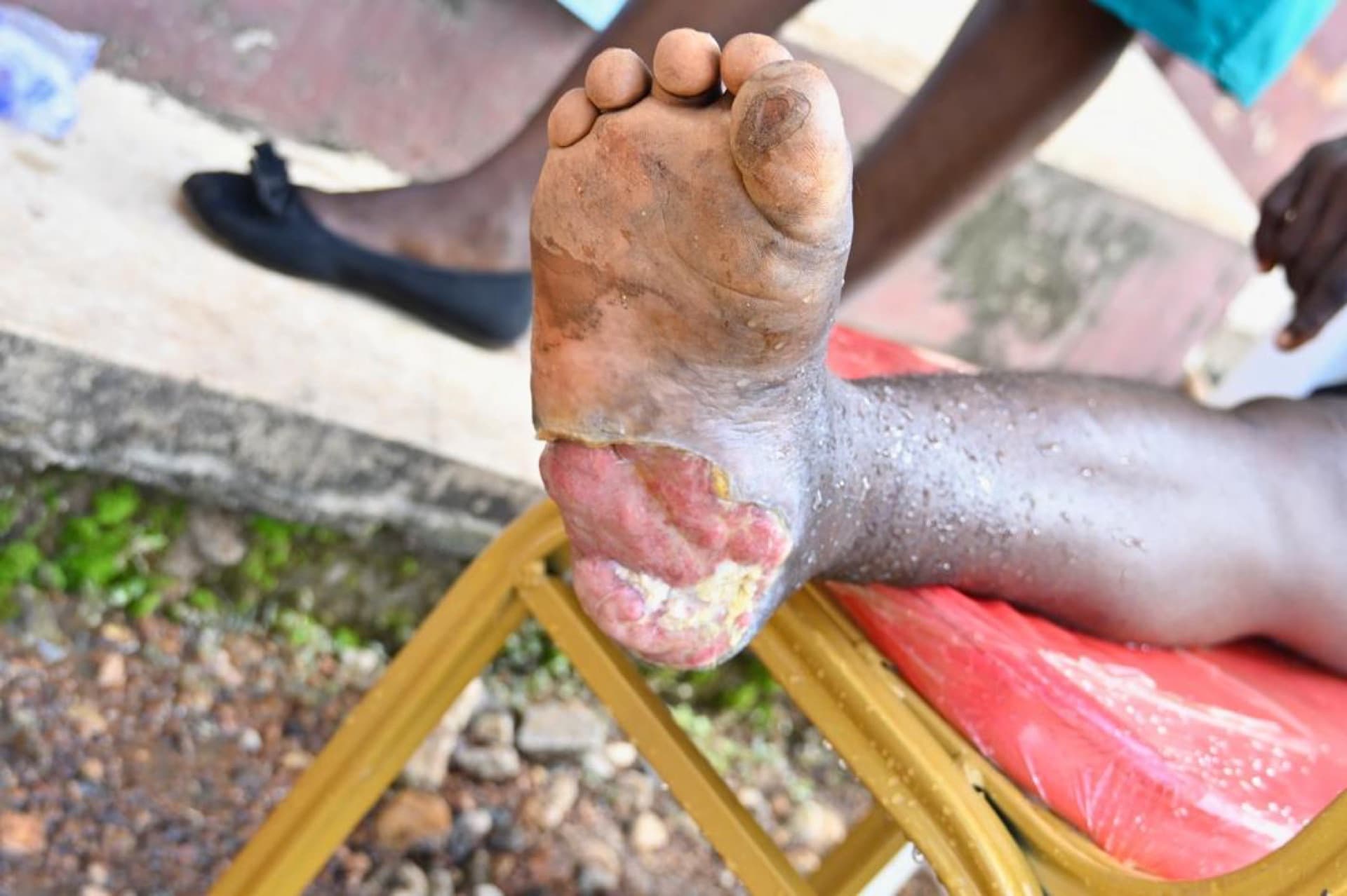 Anidaso Health mission photo